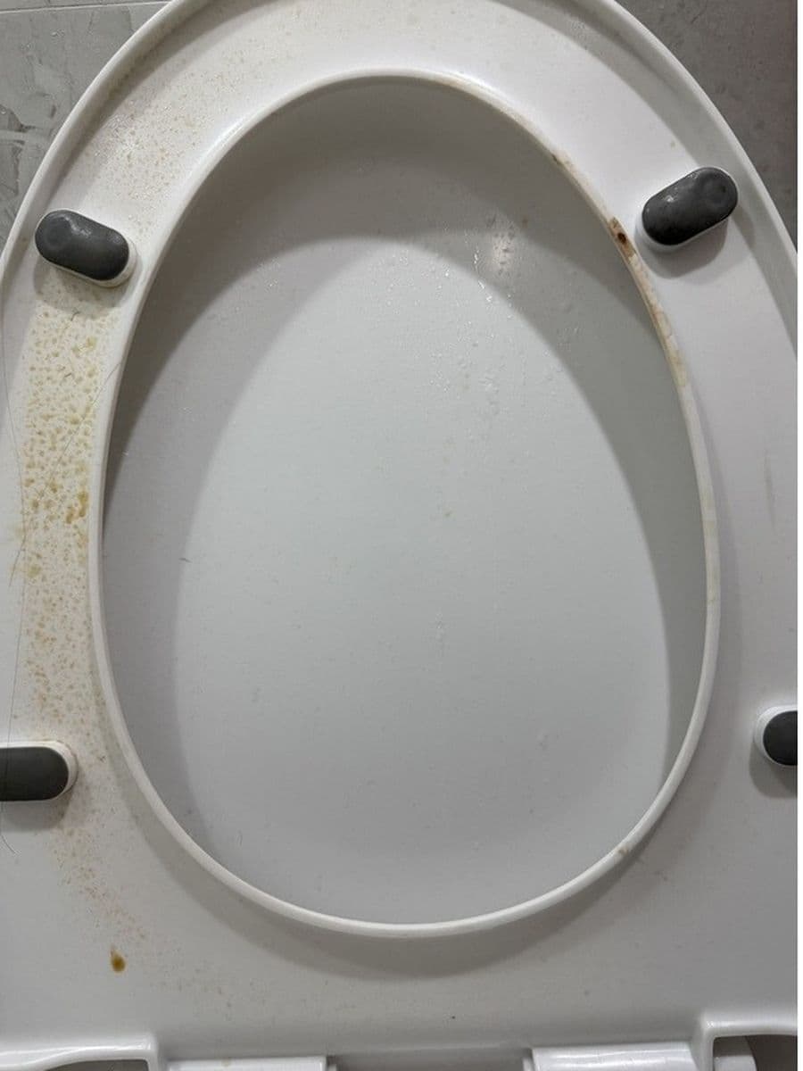 Under the toilet seat before cleaning by Red Deer House Cleaning